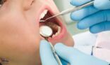 دراسة: مشاكل الفم تؤدي لهذه الأمراض الخطيرة