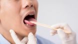 6 أعراض لسرطان الفم يجب أن يعرفها الجميع
